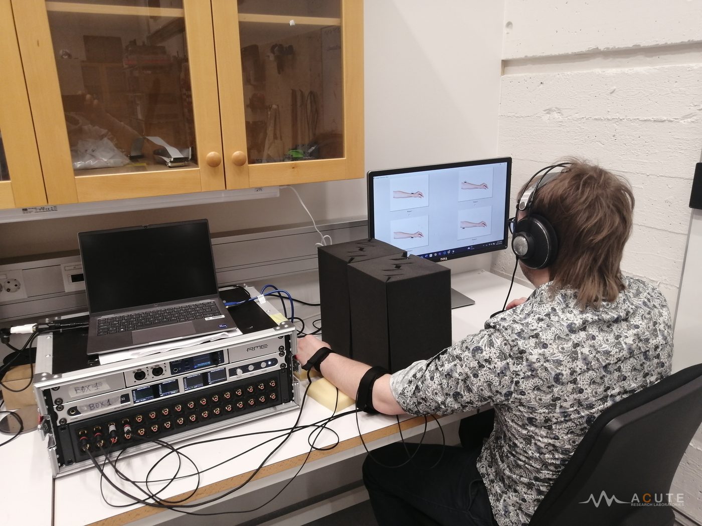 Prosthetic Haptic Feedback